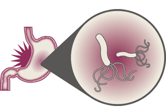 ピロリ菌とは？