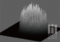 従来の【カウシアン型】