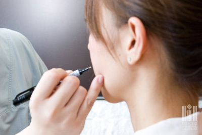 注入する部位を確認