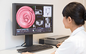 CT（80列マルチスライス）